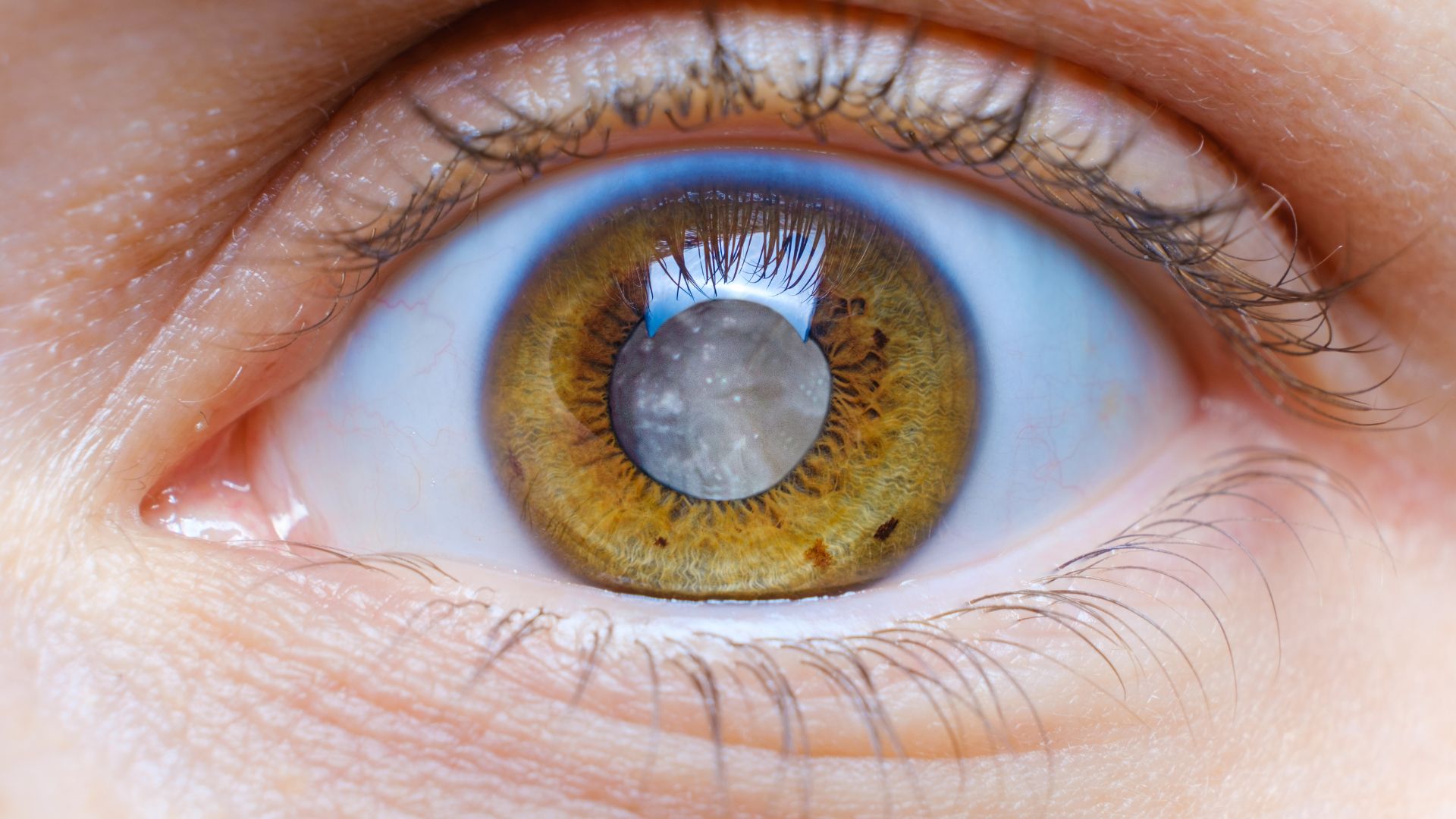 A detailed cross-section diagram depicting the anatomy of a healthy eye and an eye affected by cataracts. The foreground showcases the lens, highlighting the clouding and crystallization that occurs in cataract development. The middle ground illustrates the subtle vision changes, such as blurred or distorted images, glare, and difficulty seeing at night. The background provides a contrasting view of the unobstructed visual pathway in a healthy eye. The lighting is soft and diffused, emphasizing the delicate nature of the eye structure. The overall mood is informative and educational, guiding the viewer to better understand the causes and impact of cataracts on visual perception. Cataract Symptoms 001