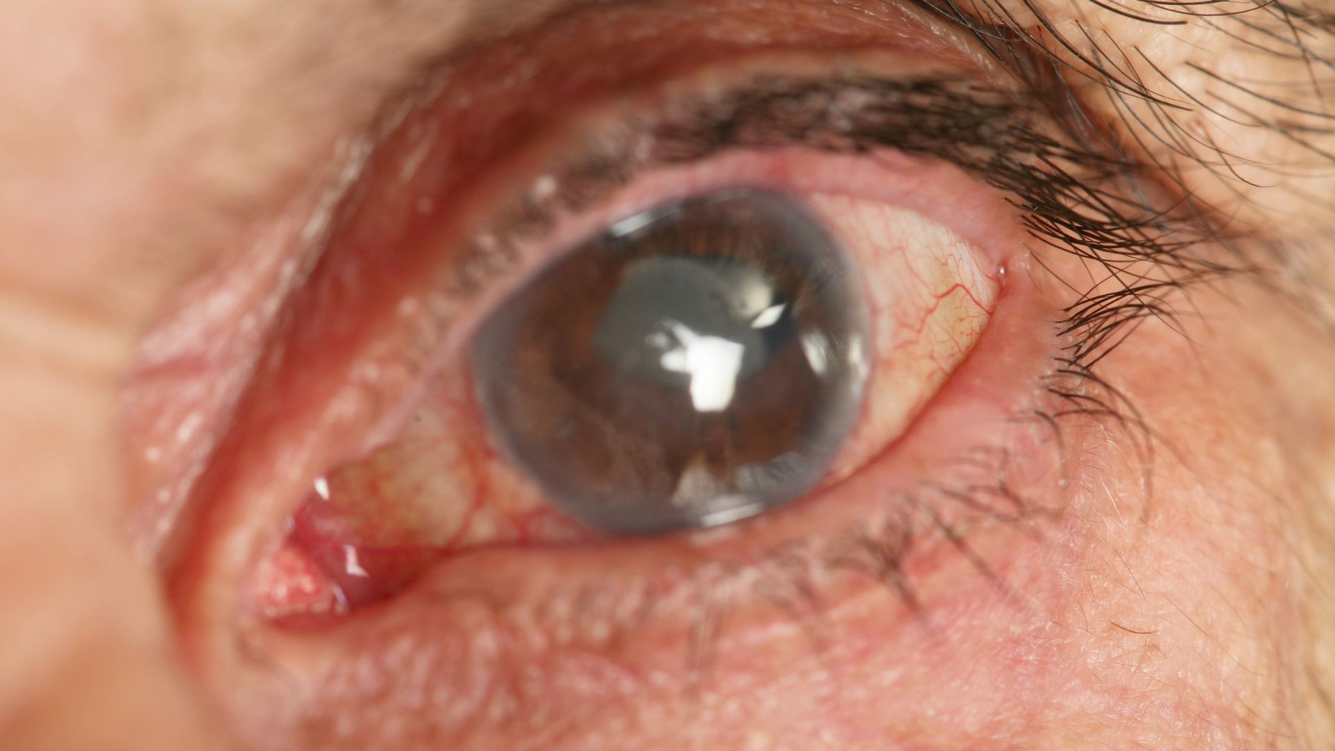 A well-lit, detailed illustration depicting cataracts prevention strategies. In the foreground, a close-up view of a human eye, its lens clear and healthy. In the middle ground, a series of lifestyle factors that promote eye health: sunglasses shielding the eyes from UV radiation, a balanced diet rich in antioxidants, and regular eye exams. In the background, a softly blurred cityscape, conveying a sense of urban living and the importance of preventative measures. The scene is bathed in a warm, natural light, creating a reassuring and informative atmosphere. Cataract Symptoms 03
