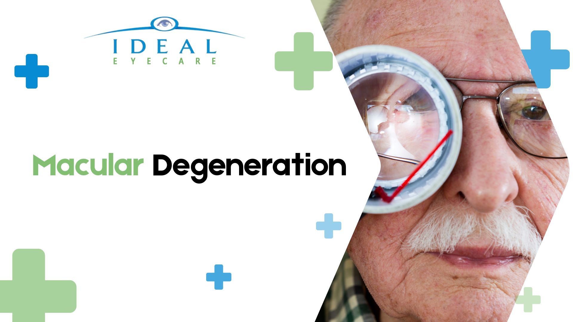 Macular Degeneration