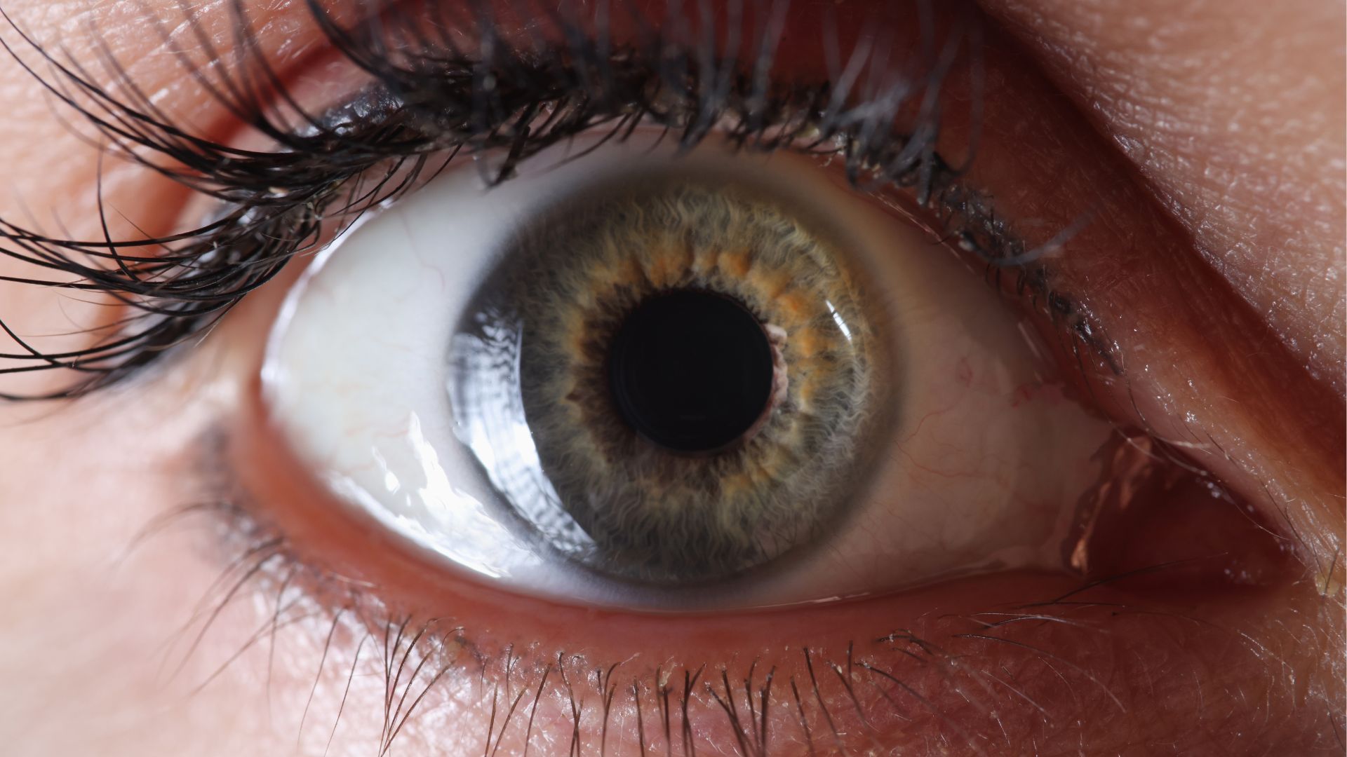 A high-resolution, detailed illustration of the key risk factors for retinal detachment, as recognized by Health Canada. In the foreground, a cross-section of the eye reveals the vitreous humor, retina, and optic nerve. In the middle ground, icons representing age, myopia, previous eye surgeries, and eye injuries are prominently displayed. The background features a subtly blurred anatomical diagram of the eye, providing context. The lighting is soft and diffused, creating a contemplative, educational mood. The image is rendered with a realistic, scientific style using a wide depth of field to emphasize the technical details. Retinal Detachment Warning Signs 2