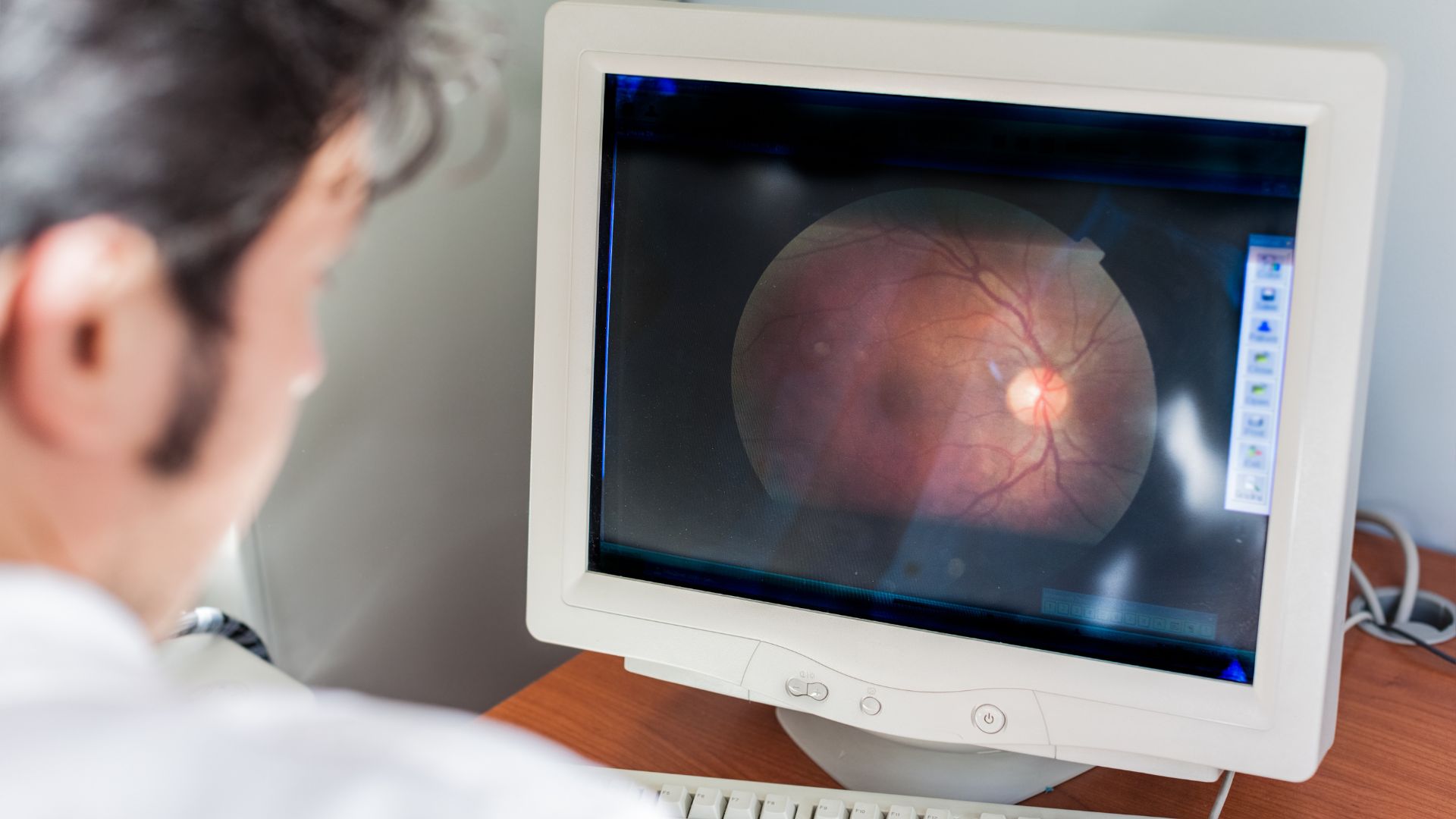 A well-lit, detailed medical illustration showcasing various retinal detachment treatment options. In the foreground, a high-resolution cross-section of the eye, revealing the retina, optic nerve, and vitreous humor. In the middle ground, three distinct treatment techniques are depicted with precision: scleral buckle, laser photocoagulation, and vitrectomy surgery. Each procedure is illustrated with technical accuracy, highlighting the key steps and equipment used. The background features a blurred, clinical setting with medical equipment and lighting, conveying a sense of professionalism and authority. The overall composition and color palette evoke a thoughtful, educational tone suitable for a medical article on retinal detachment. Retinal Detachment Warning Signs 5