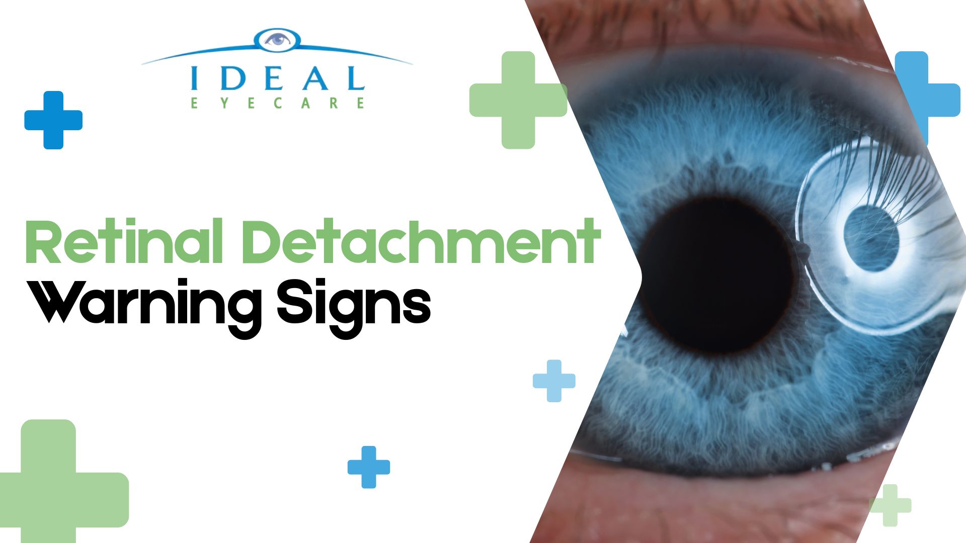 Retinal Detachment Warning Signs