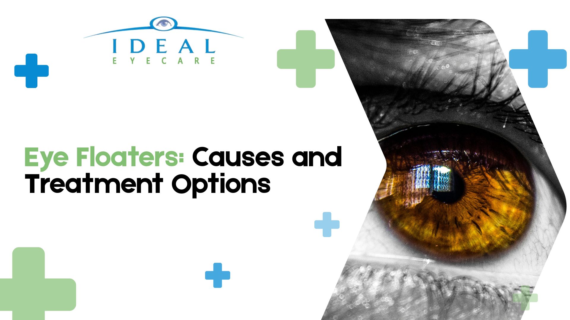 eye floaters