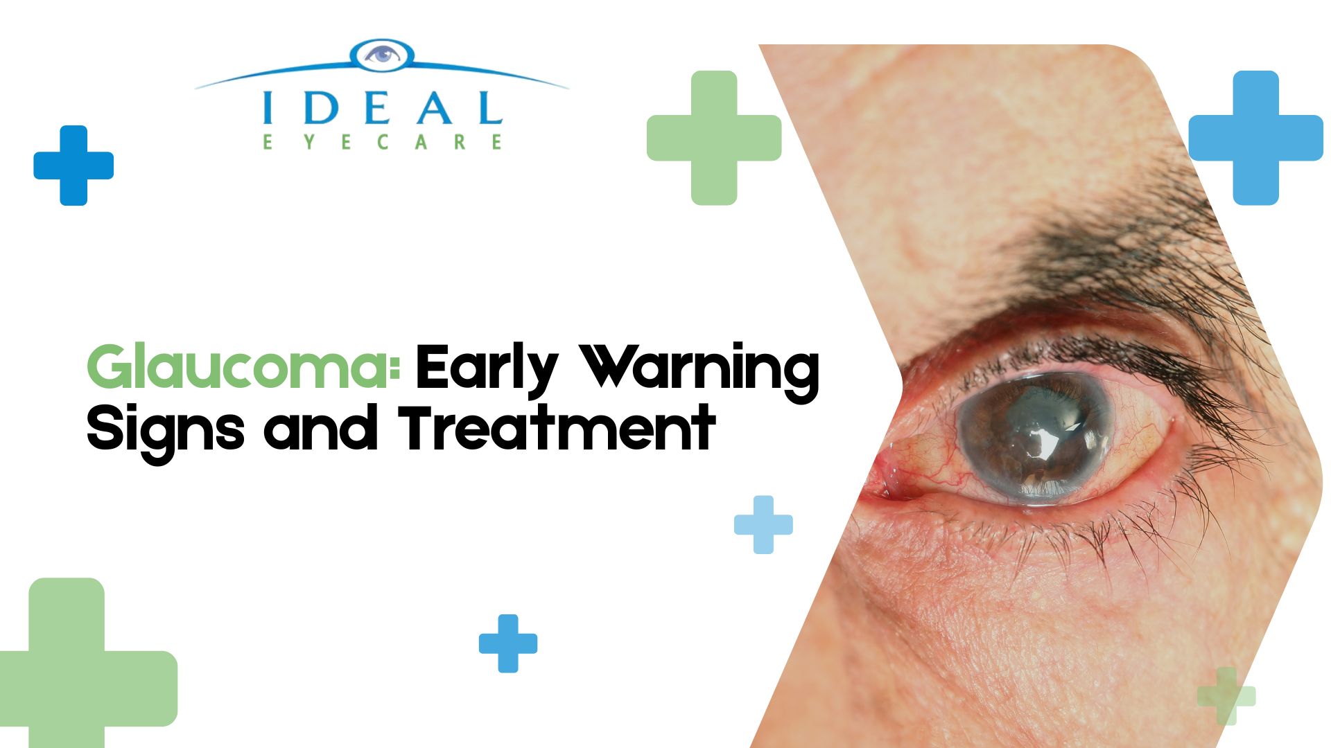 understanding glaucoma